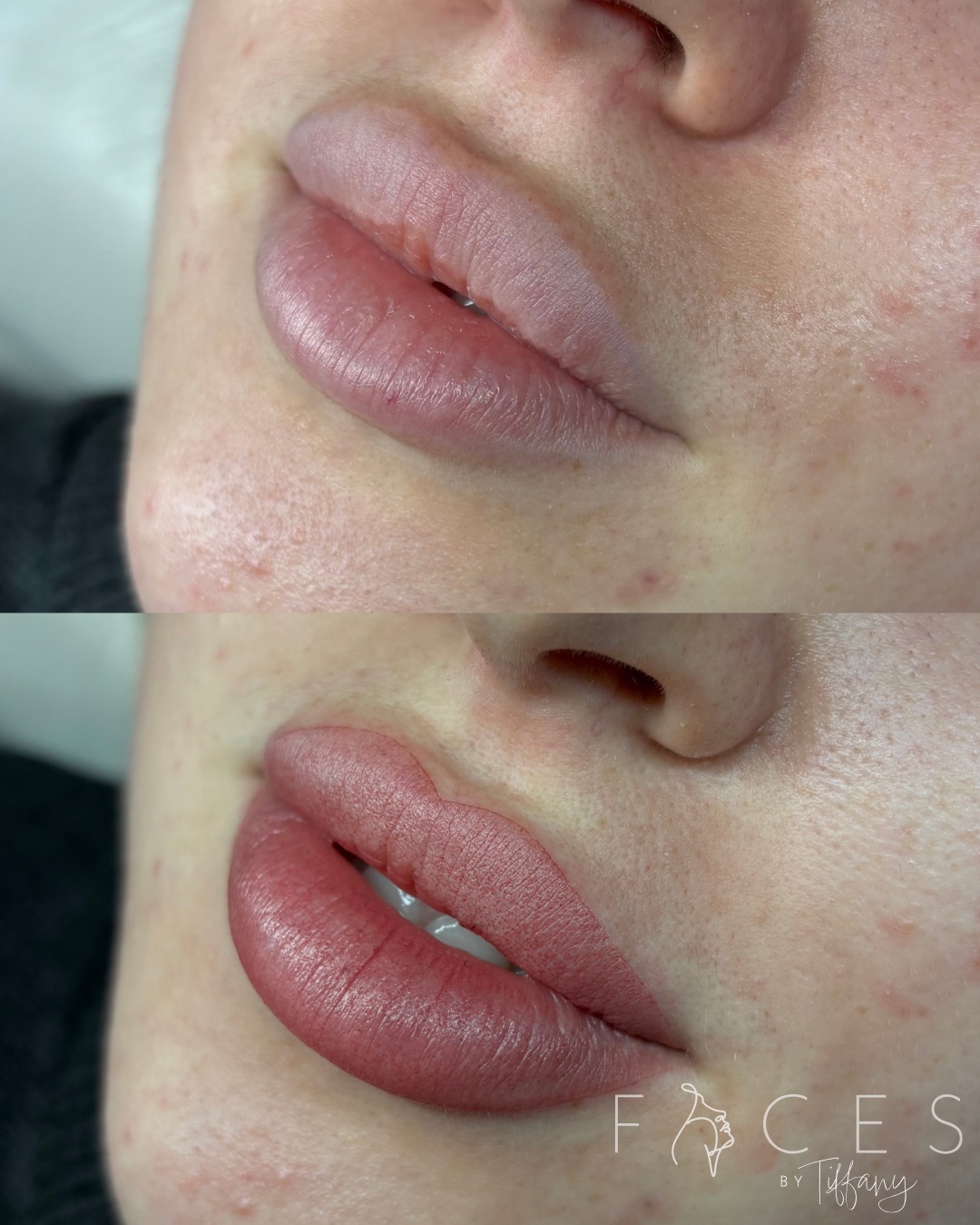 Lip blush before and after showing natural to rosy pink, Exeter clinic