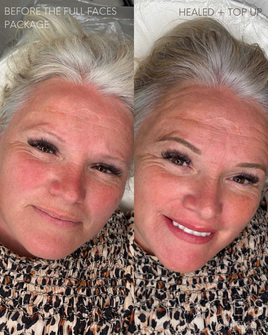 Full faces package before and after with brows and lips, Faces by Tiffany Exeter