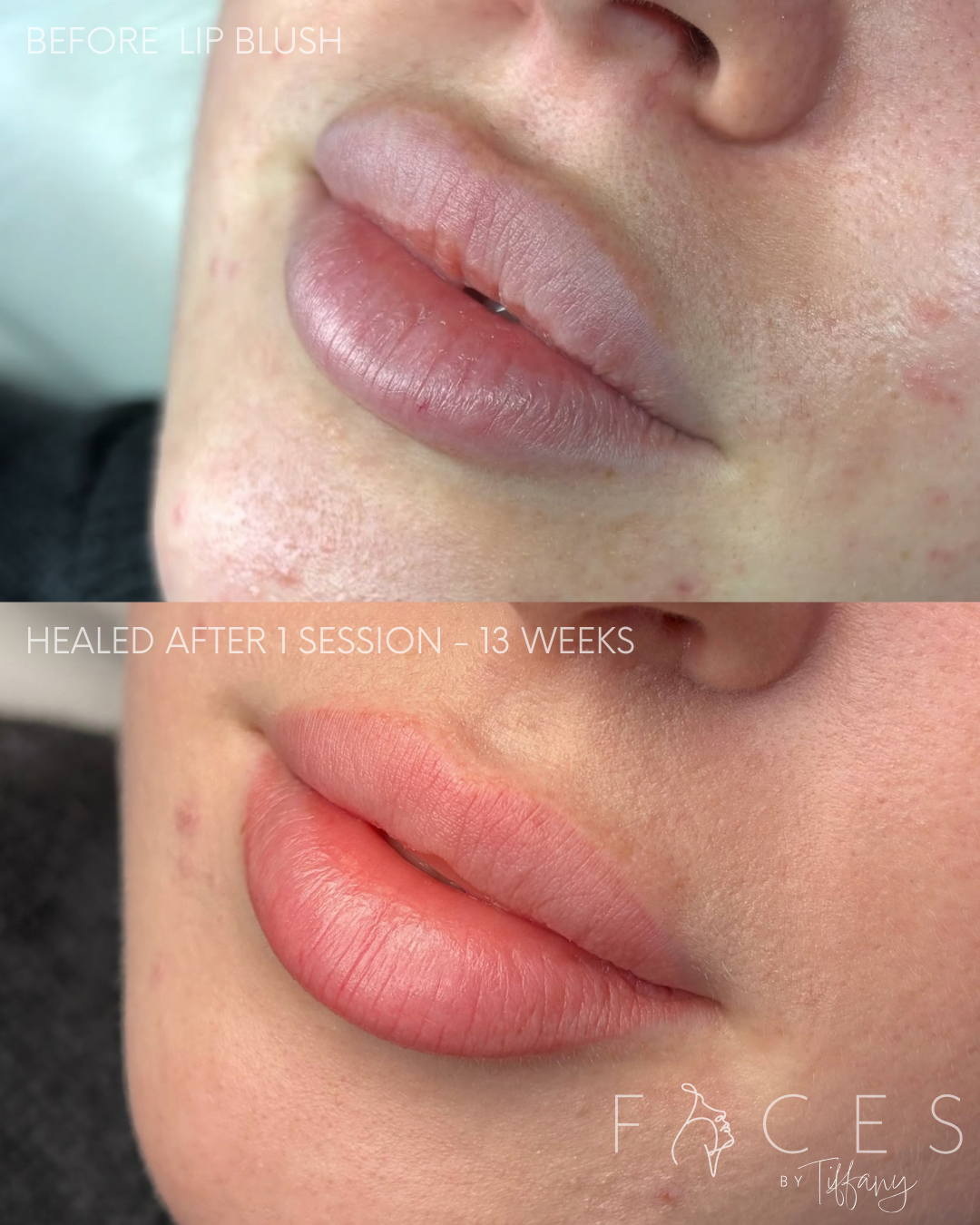 Lip blush before and healed after 13 weeks, Faces by Tiffany Exeter