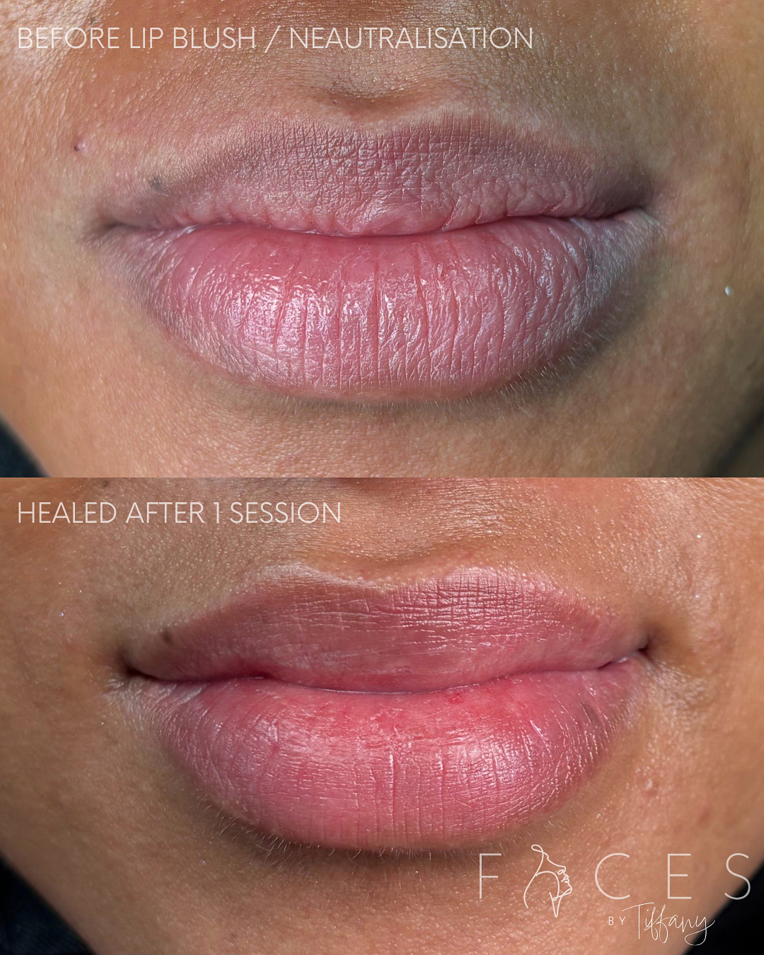 Lip blush neutralisation before and after healed, Faces by Tiffany Exeter