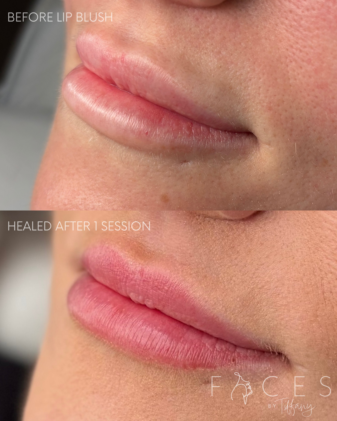 Before and after lip blush side profile, Faces by Tiffany Exeter